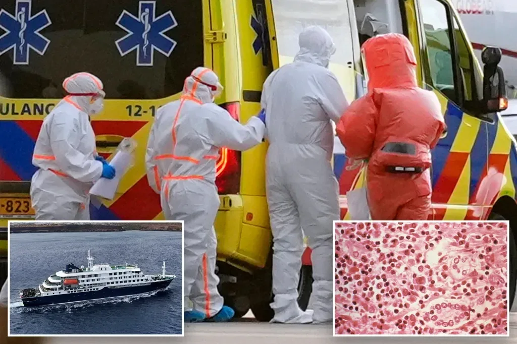 CDC Activates Level 3 Emergency Response Following Hantavirus Outbreak on MV Hondius Cruise Ship