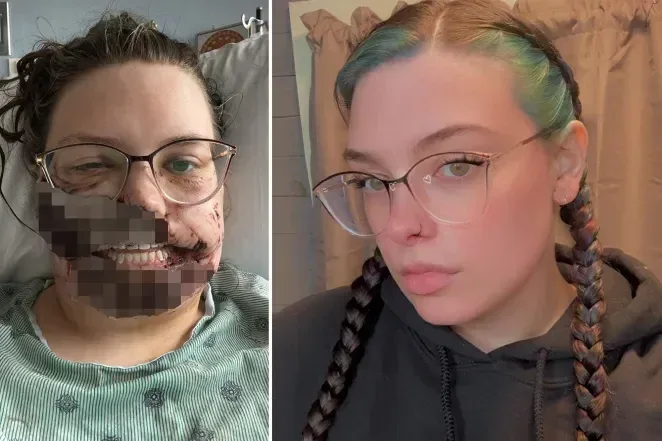 Peoria: Phụ nữ 25 tuổi bị chó nhà cắn trọng thương vùng mặt sau cơn động kinh